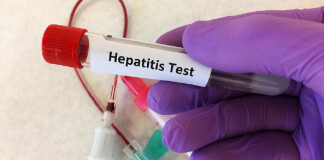 Presencia de hepatitis de etiología desconocida en niños y niñas ya está en México