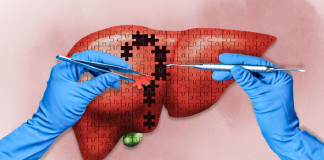 ¿Por qué hay hepatitis aguda grave en niños?