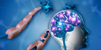 Mujeres, dos terceras partes de quienes tienen esclerosis múltiple .