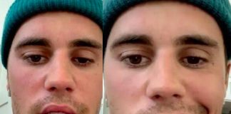 Justin Bieber se aleja de los escenarios, Afronta parálisis facial.