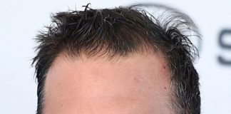 Productor es señalado por forzar a Bruce Willis a trabajar con Afasia .