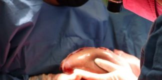 Llama IMSS Veracruz Sur a ser donadores de órganos altruistas .