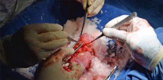 Donación de dos riñones de Jubilada del IMSS salva la vida de dos pacientes