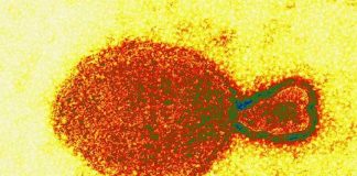 El nuevo henipavirus Langya de China, otro virus en el horizonte