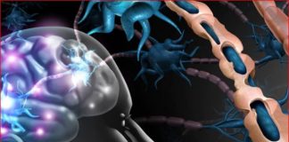 Esclerosis Múltiple: Tipos, Causas, Síntomas y Tratamiento .