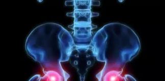 Ejercicio y alimentación adecuada podrían prevenir fracturas de cadera.