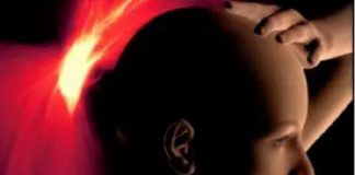 Ictus, enfermedad prevenible y más común en mujeres