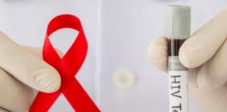 Veracruz, líder nacional en VIH .