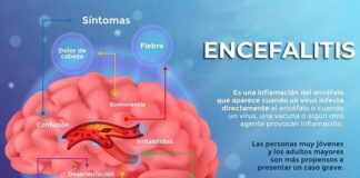 Sabes cuáles son los síntomas de encefalitis .