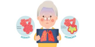 Neumonía en Adultos, cómo y en donde se adquiere .