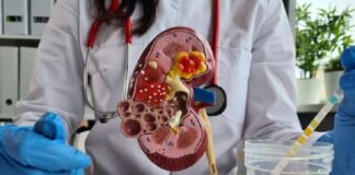 Alimentación clave para prevenir enfermedades crónicas y daños en el riñón: IMSS Veracruz Sur