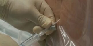 En EU asocian casos de meningitis en México con anestesia espinal.