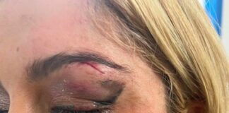 Cantante Bebe Rexha recibe golpe de un celular en pleno concierto y detienen al agresor .