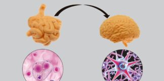 El Parkinson: más allá del temblor.