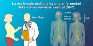 La esclerosis múltiple es más común en jóvenes adultos y mujeres .