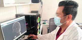 Cuidado con los traumatismos craneoencefálicos, advierte IMSS Veracruz Norte