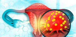 Seguir estrategia de la OMS para reducir el cáncer cervicouterino.