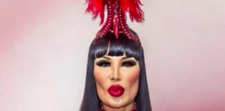 Lyn May presumió su nueva cirugía estética .