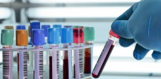 Conocer esto podría salvarle la vida en caso de intervención quirurgica.