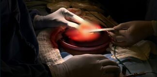 Veracruz hace historia: realizan con éxito la primera cirugía fetal en hospital público