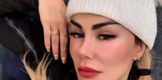 Ninel Conde narra su trágico accidente: “en el último día y de la manera más tonta”.