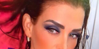 Lisset sufre fuerte accidente en la calle.