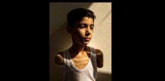 World Press Photo: Premiada la foto de un niño amputado de Gaza.