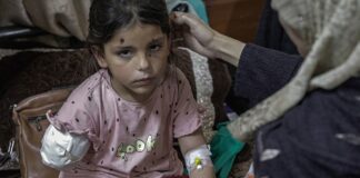 Gaza: “Niños con metralla en el corazón y balas en el cerebro”.