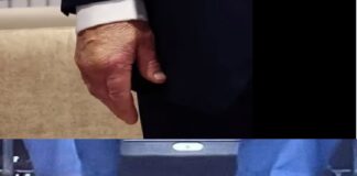 Donald Trump fue diagnosticado con “insuficiencia venosa crónica” tras rumores.