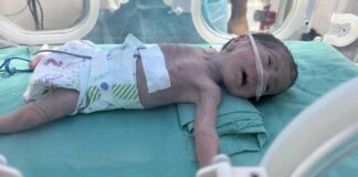 La hambruna masiva en Gaza es fabricada y deliberada, acusa UNRWA