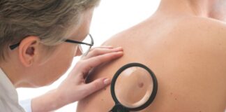 Informan sobre lesiones benignas y malignas en piel