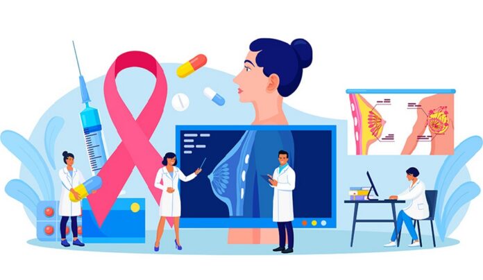 Cancer de mama invetigacion