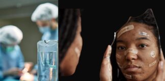 Con Ley Nicole, prohibirían cirugías estéticas en adolescentes.