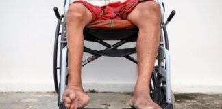 Poliomielitis, enfermedad viral que afecta nervios de médula ósea.