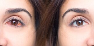 Síndrome de Sjögren, cuando los ojos y la boca se secan.