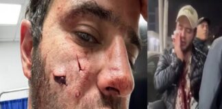 Pakistaní atacó a un judío mexicano en la Colonia Roma .