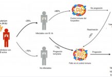 Tuberculosis, enfermedad infecciosa que más ha afectado a la humanidad .