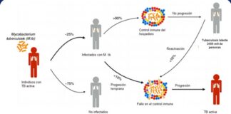 Tuberculosis, enfermedad infecciosa que más ha afectado a la humanidad .