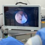 Veracruz, a la vanguardia con procesos quirúrgicos en pacientes renales.