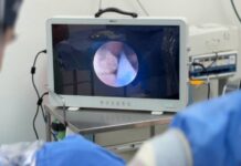 Veracruz, a la vanguardia con procesos quirúrgicos en pacientes renales.