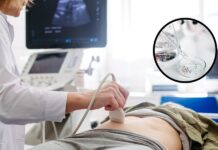 Microplásticos amenazan la salud reproductiva de las mujeres, advierten estudios.