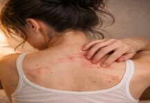 Dermatilomanía o lacerar la piel, trastorno en mujeres por presión social para mejorar apariencia.