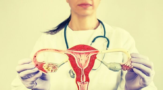 Cáncer de ovario, el de mayor mortalidad en México.