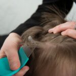 #Piojos: Exhortan a prevenir pediculosis mediante detección y atención oportuna
