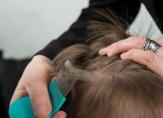 #Piojos: Exhortan a prevenir pediculosis mediante detección y atención oportuna